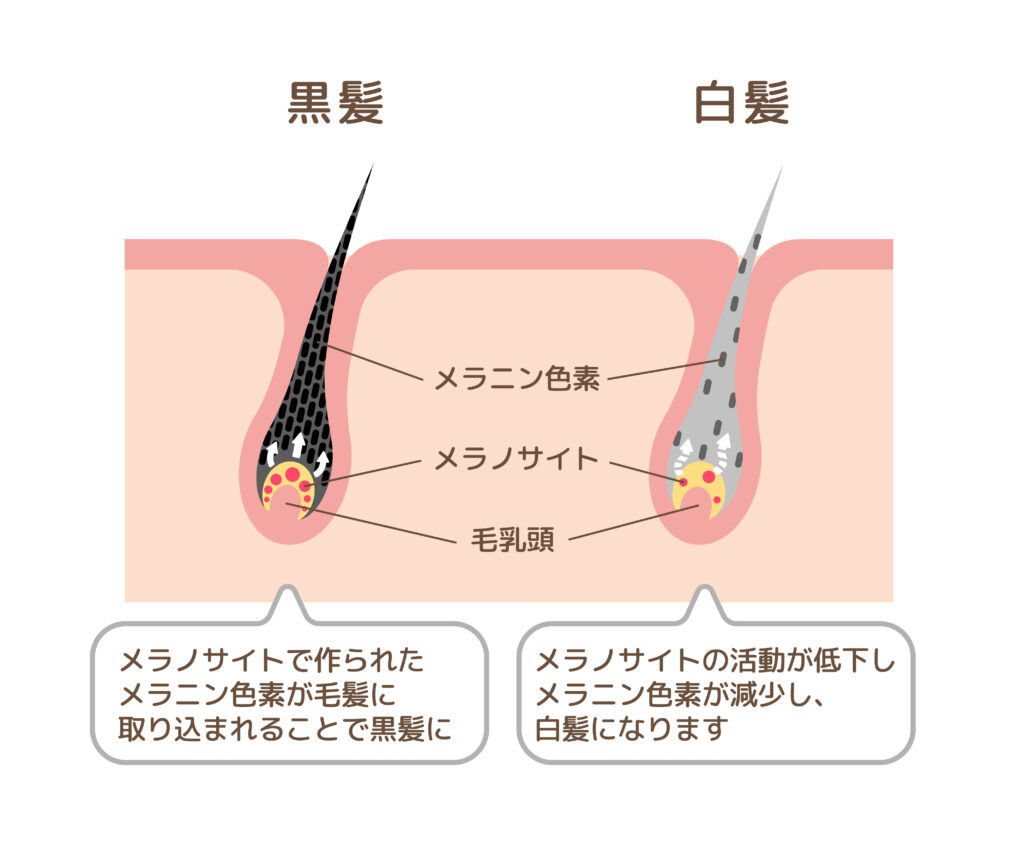 白髪になってしまう仕組み