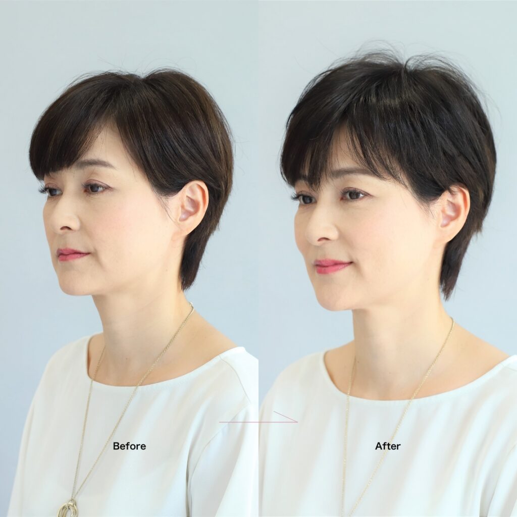 自然なヘアスタイルを作る部分用オーダーメイドウィッグ