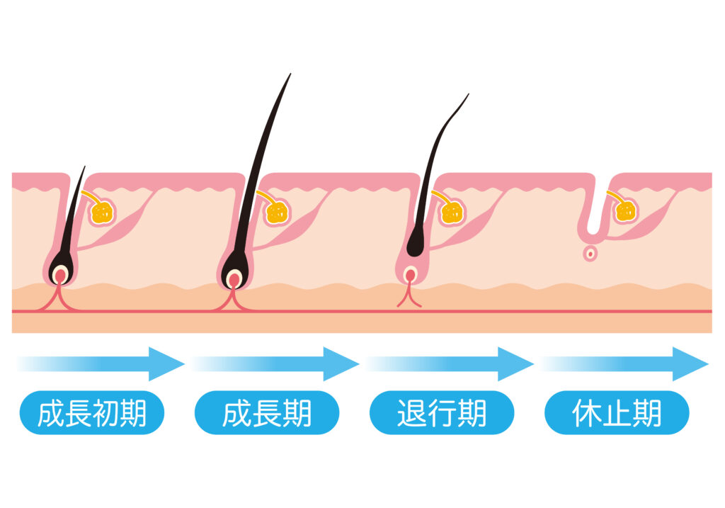 女性の薄毛や抜け毛の主な原因