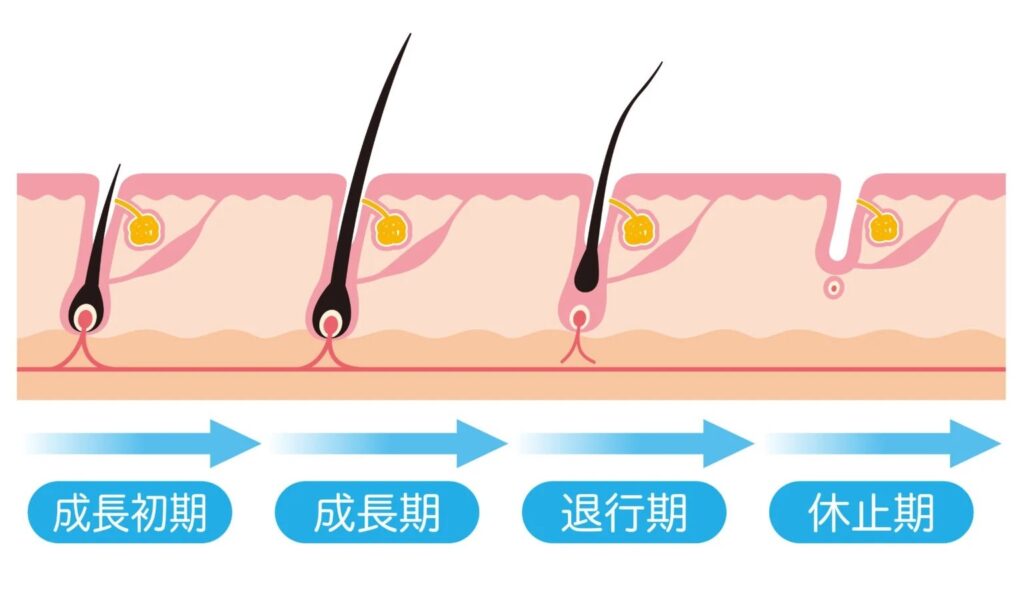 休止期脱毛症