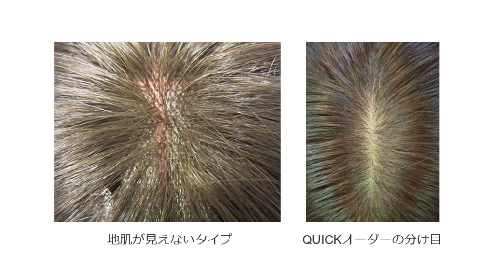 「つむじ」「分け目」あり・無し