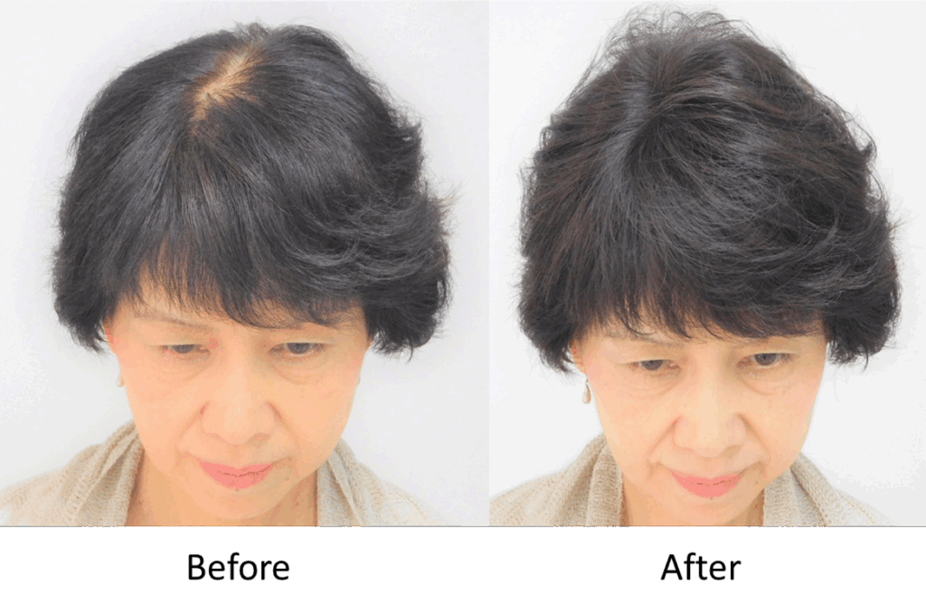 「気になるところだけ」を自然にカバーするという選択肢